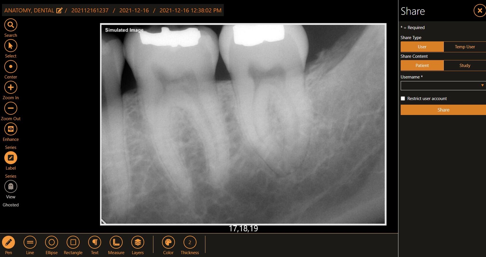 screenshot of Apteryx XVWeb